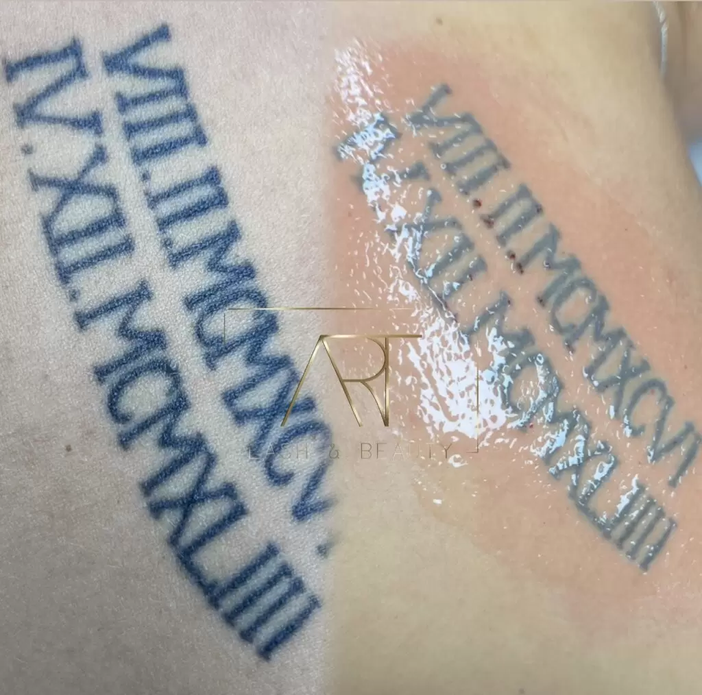 permanent make up entfernen basel